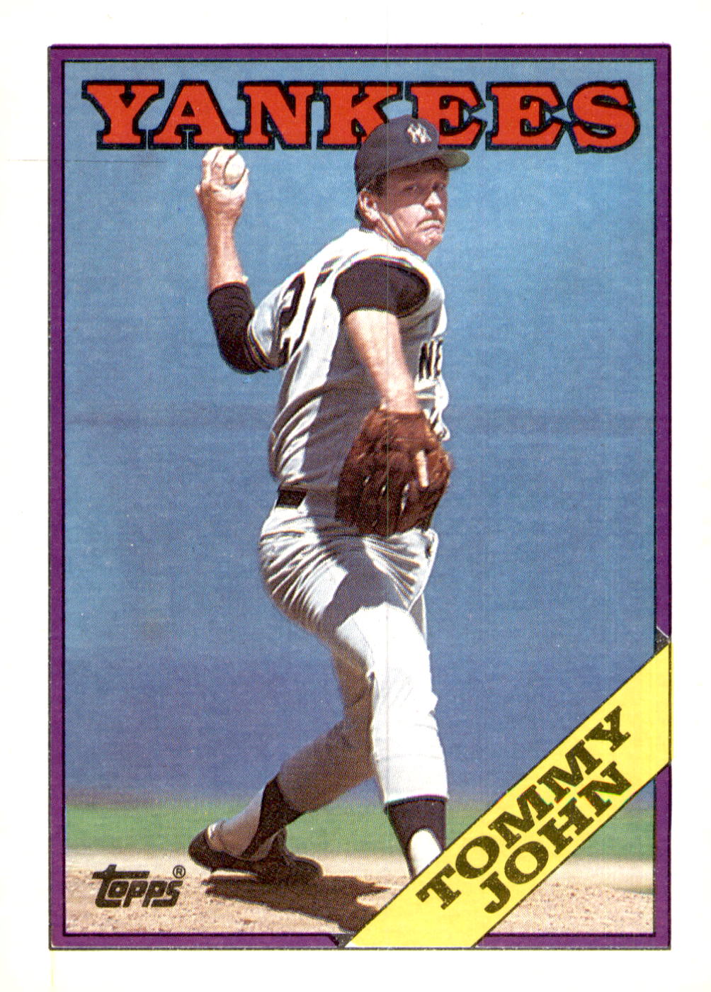 1988 Topps #611 Tommy John